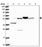 ACSM6 Antibody in Western Blot (WB)