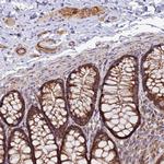 TIGD6 Antibody in Immunohistochemistry (Paraffin) (IHC (P))