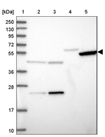 TIGD6 Antibody in Western Blot (WB)