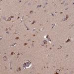 TMEM258 Antibody in Immunohistochemistry (Paraffin) (IHC (P))