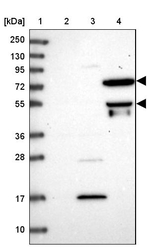 HPa2 Antibody in Western Blot (WB)