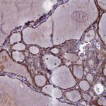 ARL15 Polyclonal Antibody