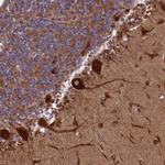 SPOCK2 Antibody in Immunohistochemistry (IHC)