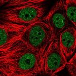 ENOPH1 Polyclonal Antibody