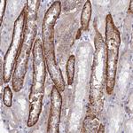 CHSY3 Polyclonal Antibody