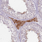 PTCHD3 Antibody in Immunohistochemistry (Paraffin) (IHC (P))