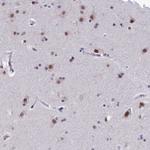 OBFC2B Antibody in Immunohistochemistry (Paraffin) (IHC (P))
