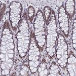 OBFC2B Antibody in Immunohistochemistry (Paraffin) (IHC (P))