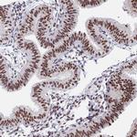 OBFC2B Antibody in Immunohistochemistry (Paraffin) (IHC (P))