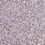 OBFC2B Antibody in Immunohistochemistry (Paraffin) (IHC (P))