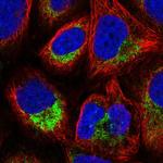 ATP5L Polyclonal Antibody