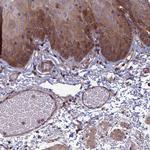 C15orf62 Polyclonal Antibody