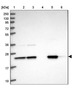 GNPNAT1 Antibody in Western Blot (WB)