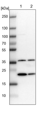 GNPNAT1 Antibody in Western Blot (WB)