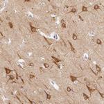 CTTNBP2 Antibody in Immunohistochemistry (Paraffin) (IHC (P))