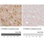 CTTNBP2 Antibody in Immunohistochemistry (IHC)
