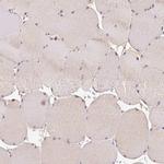 CTTNBP2 Antibody in Immunohistochemistry (IHC)