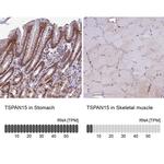 TSPAN15 Antibody