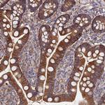 GPR41 Polyclonal Antibody