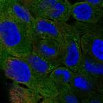 PLIN4 Polyclonal Antibody