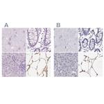 PLIN4 Antibody in Immunohistochemistry (IHC)