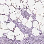 PLIN4 Antibody in Immunohistochemistry (IHC)