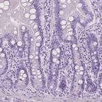 PLIN4 Antibody in Immunohistochemistry (IHC)