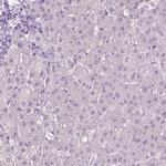 PLIN4 Antibody in Immunohistochemistry (IHC)