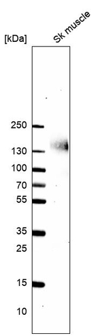 PLIN4 Antibody in Western Blot (WB)