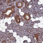 CCDC160 Antibody in Immunohistochemistry (Paraffin) (IHC (P))