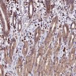 PPP1R26 Antibody in Immunohistochemistry (Paraffin) (IHC (P))