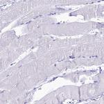 PNMA5 Antibody in Immunohistochemistry (Paraffin) (IHC (P))