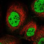 KIAA1191 Antibody in Immunocytochemistry (ICC/IF)