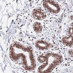 KIAA1191 Antibody in Immunohistochemistry (Paraffin) (IHC (P))