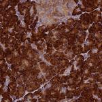 RNaseK Polyclonal Antibody