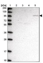 CLCN3 Antibody in Western Blot (WB)