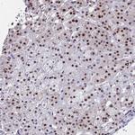 KLF14 Antibody in Immunohistochemistry (Paraffin) (IHC (P))
