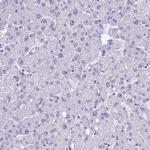 KLF14 Antibody in Immunohistochemistry (Paraffin) (IHC (P))