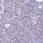 KLF14 Polyclonal Antibody