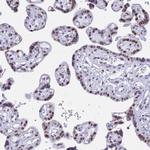 KLF14 Antibody in Immunohistochemistry (Paraffin) (IHC (P))