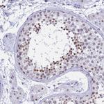 KLF14 Antibody in Immunohistochemistry (Paraffin) (IHC (P))