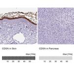 CDSN Antibody in Immunohistochemistry (IHC)