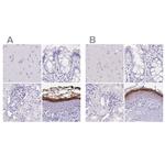 CDSN Polyclonal Antibody