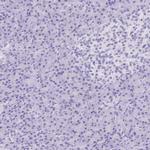 CDSN Antibody in Immunohistochemistry (IHC)