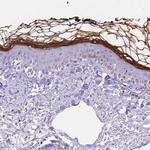 CDSN Antibody in Immunohistochemistry (IHC)
