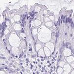 CDSN Antibody in Immunohistochemistry (IHC)