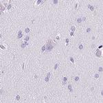 CDSN Antibody in Immunohistochemistry (IHC)