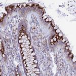 TISP43 Polyclonal Antibody