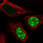 CT45A Polyclonal Antibody