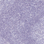 CT45A Antibody in Immunohistochemistry (Paraffin) (IHC (P))